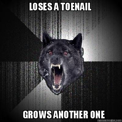 loses-a-toenail-grows-another-one