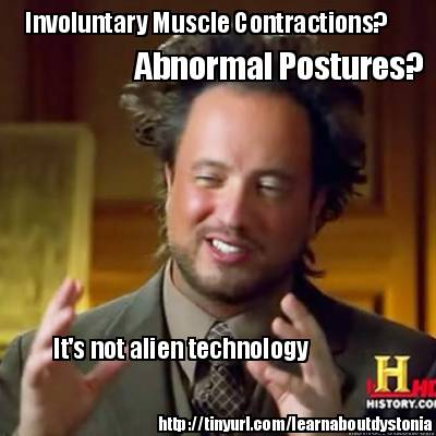 involuntary-muscle-contractions-abnormal-postures-its-not-alien-technology-httpt5